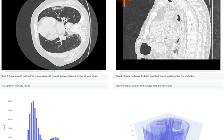 X-Ray Image Analysis preview